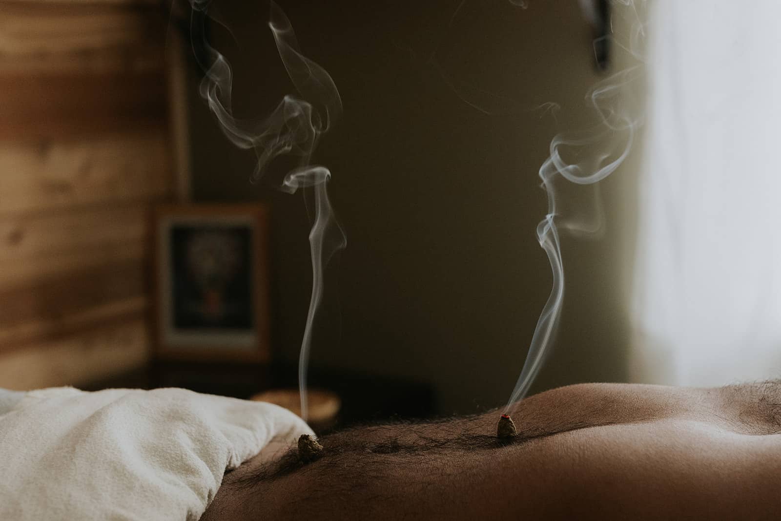 A patient relaxing on a treatment table while a skilled practitioner applies moxibustion therapy, using a moxa stick near the skin to enhance acupuncture benefits.