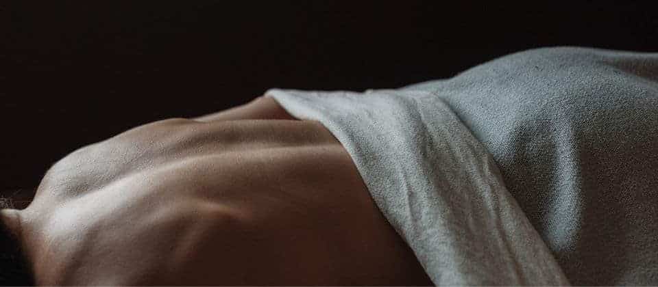 Acupuncture needles inserted along the spine for pain relief